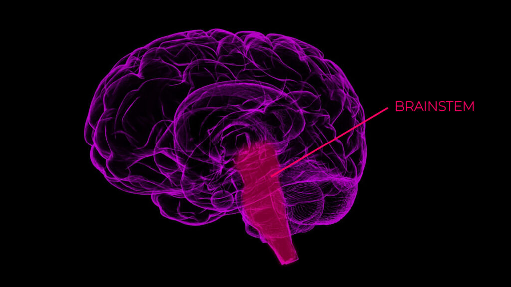 transformation brainstem